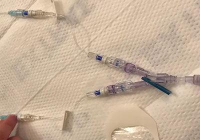 Dynamic Contrast Enhanced image