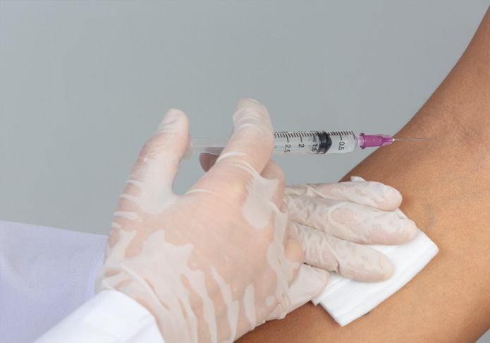 Interstitial Lymphatic Embolization