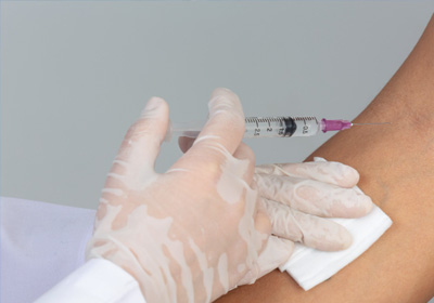 Interstitial Lymphatic Embolization